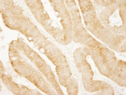 PARP4 Antibody, Novus Biologicals 0.1mL; Unlabeled:Antibodies, Polyclonal